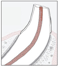 OLD DOG CANINE TEETH TRAUMA