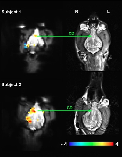 FMRI representations of neurological activity produced by reward anticipation in the brains of Callie and McKenzie. Image: Berns et al./SSRN
