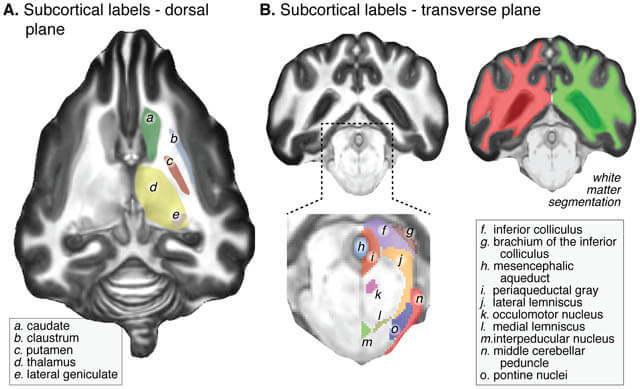 DOG BRAIN